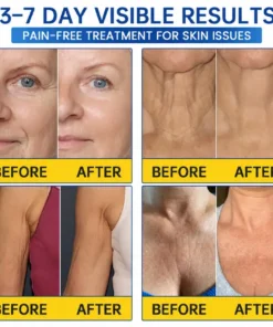 LIMETOW® PDRN Anti-Wrinkle Shot – Lift & Firming Cream