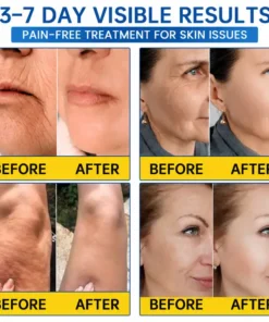 LIMETOW® PDRN Anti-Wrinkle Shot – Lift & Firming Cream