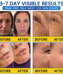 LIMETOW® PDRN Anti-Wrinkle Shot – Lift & Firming Cream