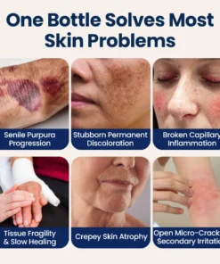 LIMETOW® ResiliVeil Bruise Appearance Barrier Care Cream