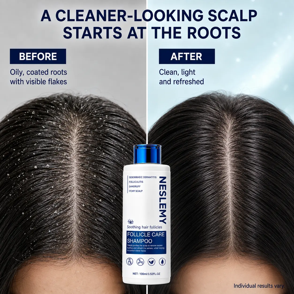 NESLEMY Folliculitis Shampoo for Itchy, Flaky & Oily Scalp - Image 14