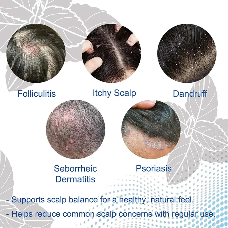 NESLEMY Folliculitis Shampoo for Itchy, Flaky & Oily Scalp - Image 2