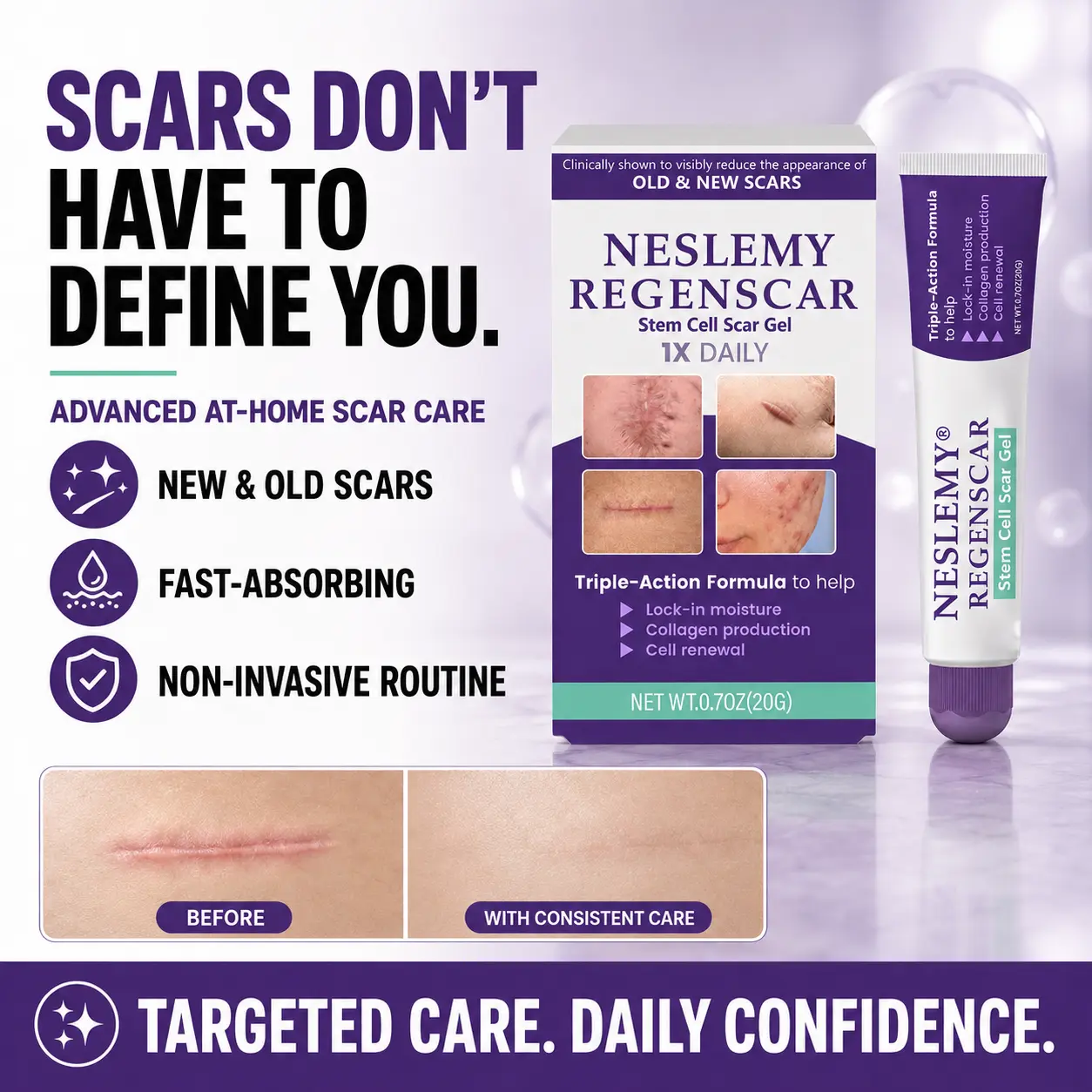 ReGenScar Stem Cell Scar Gel