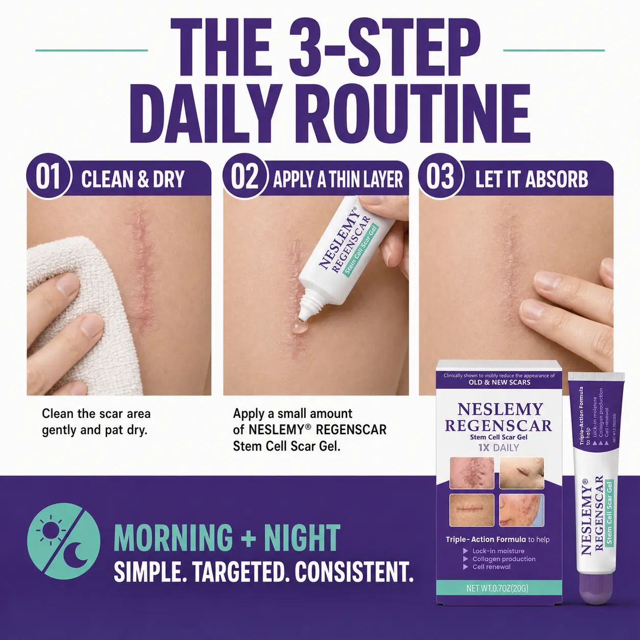 Scar Gel - Image 3