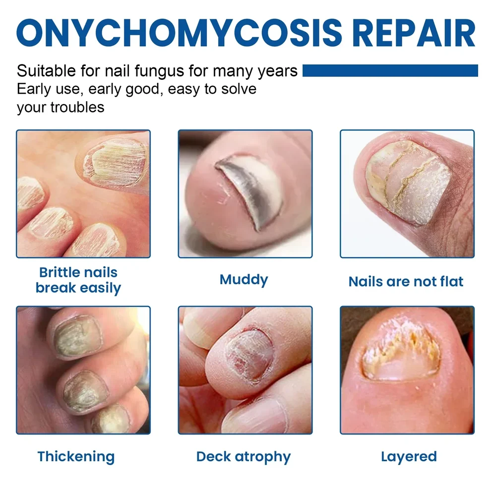 NEW 2026 Nail Repair Patches Overnight Hydrogel Care For Stronger-Looking Nails - Image 5