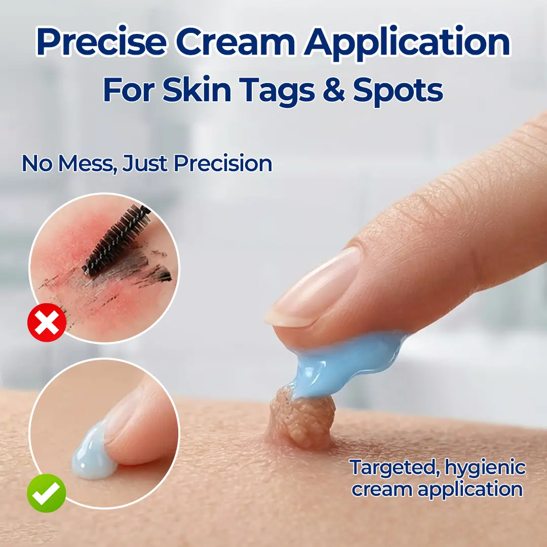 7-Day Skin Tag & Spot Eraser Cream - Image 4