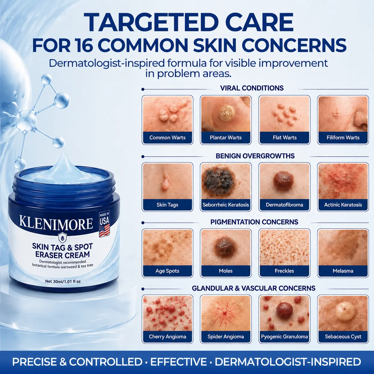 7-Day Skin Tag & Spot Eraser Cream - Image 3