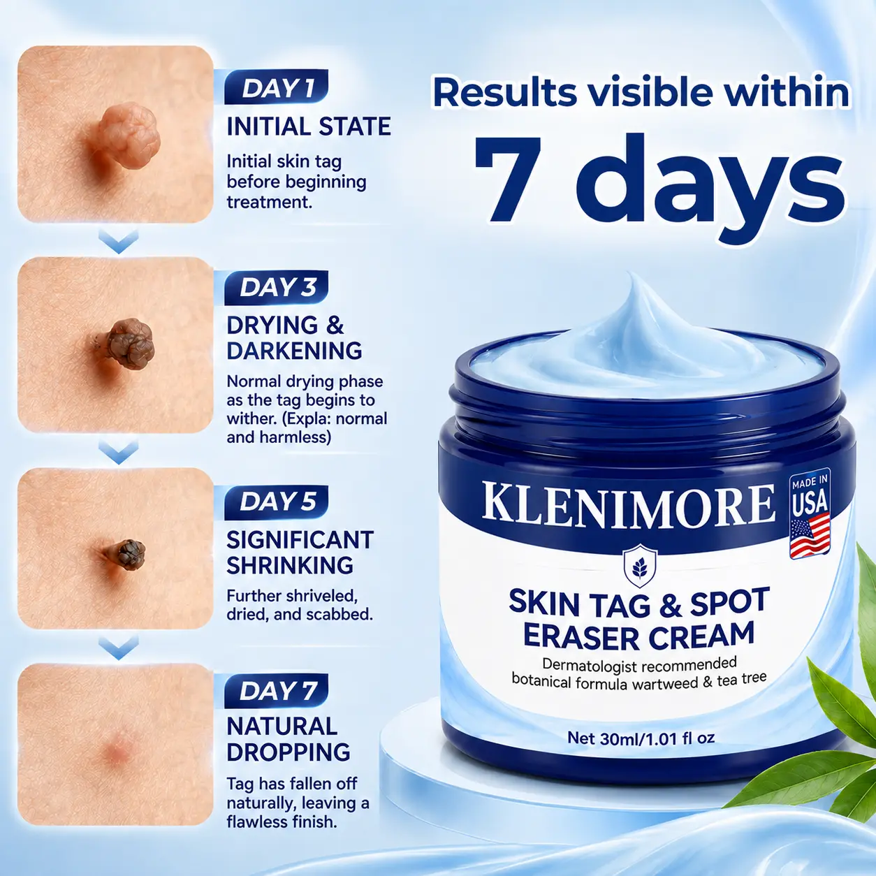 7-Day Skin Tag & Spot Eraser Cream - Image 5