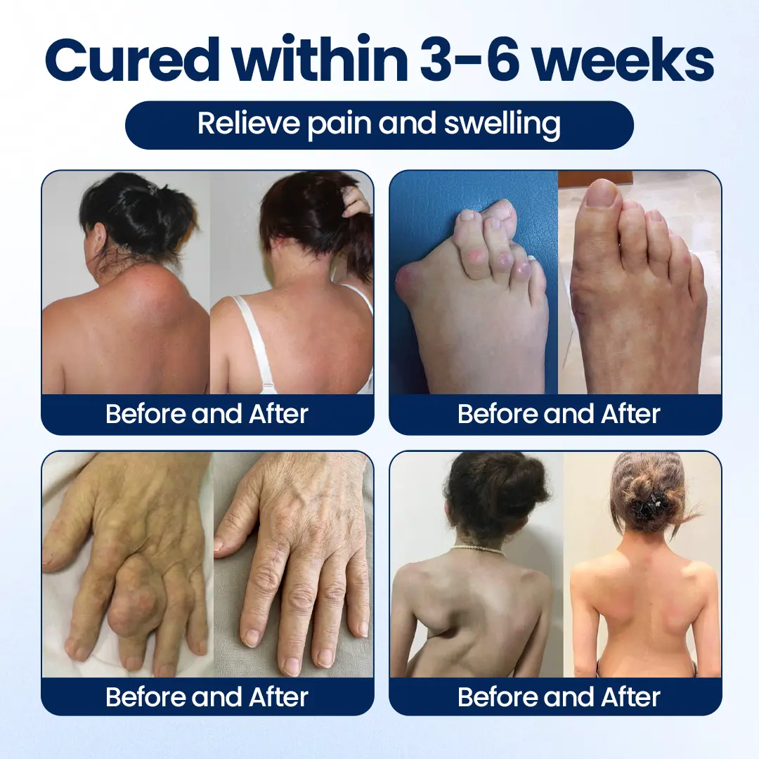 ArthriNAD+ Pro Advanced Joint Recovery Cream - Image 8