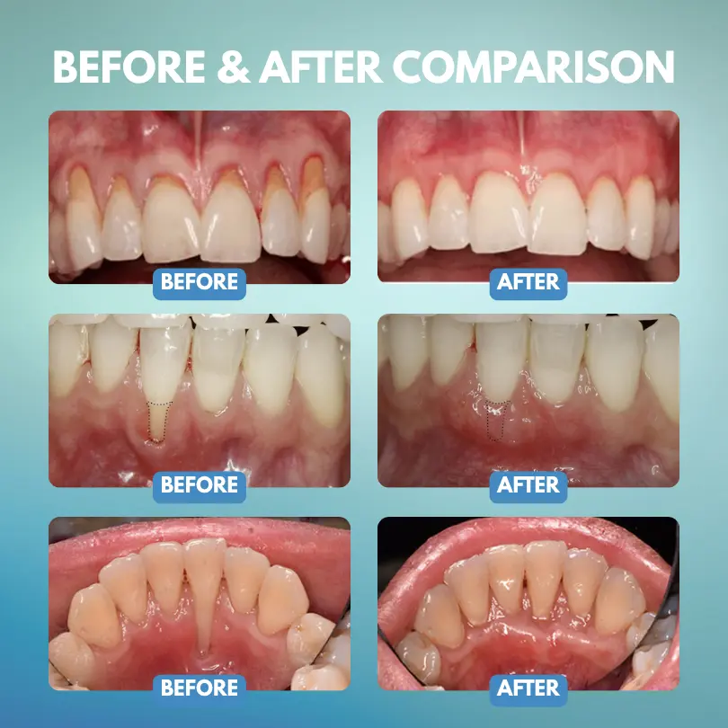 GumRescue Precision Gel - Image 2