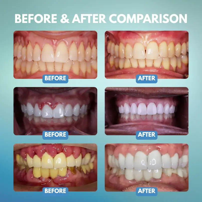 GumRescue Precision Gel - Image 3
