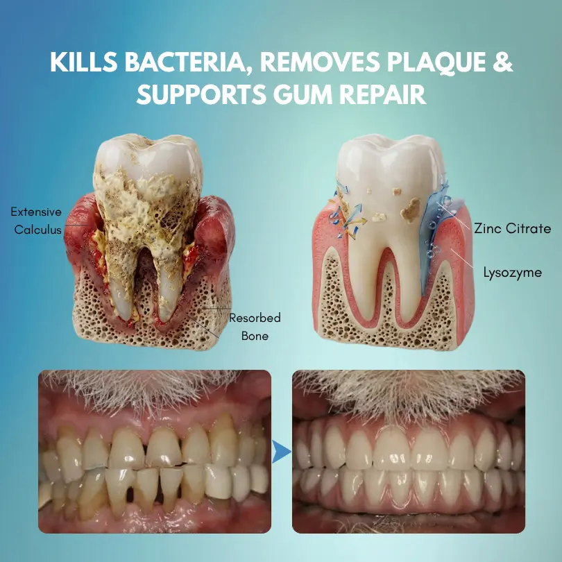 GumRescue Precision Gel - Image 5