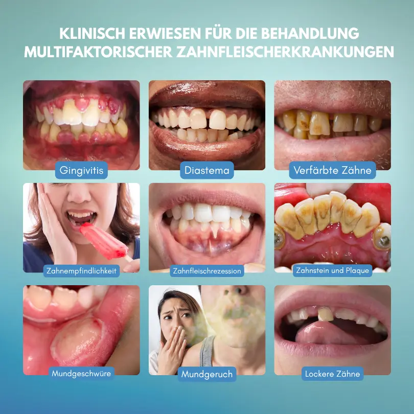 GumRescue Precision Gel - Image 9
