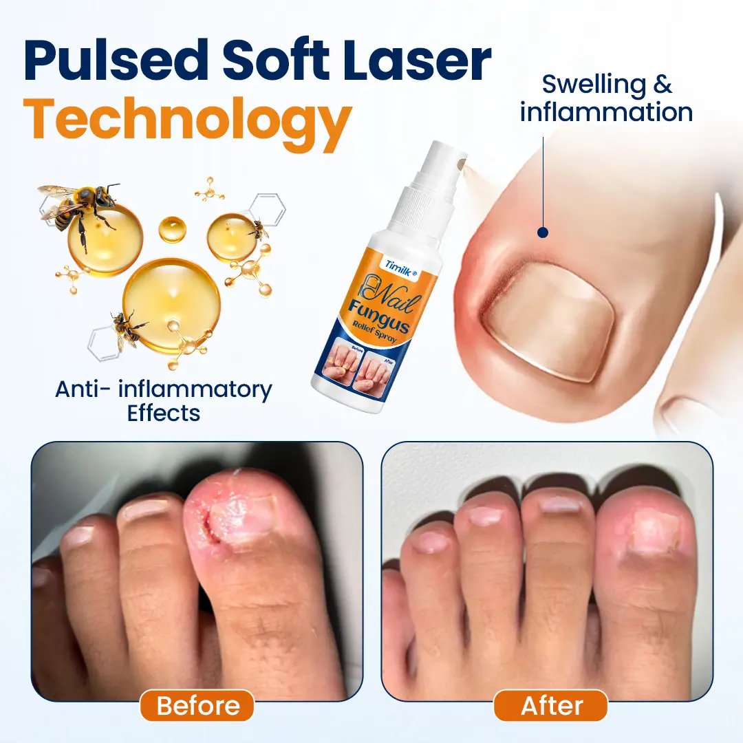 Nail Fungus Relief Spray - Image 5