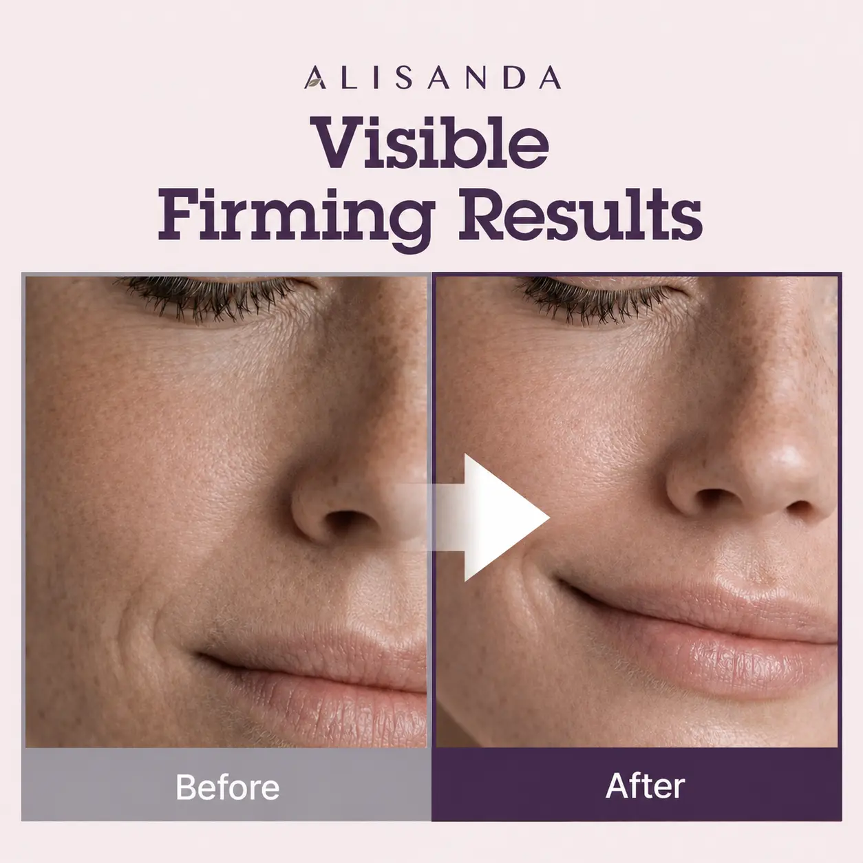 NeckRenew Anti-Aging Firming Cream - Image 7