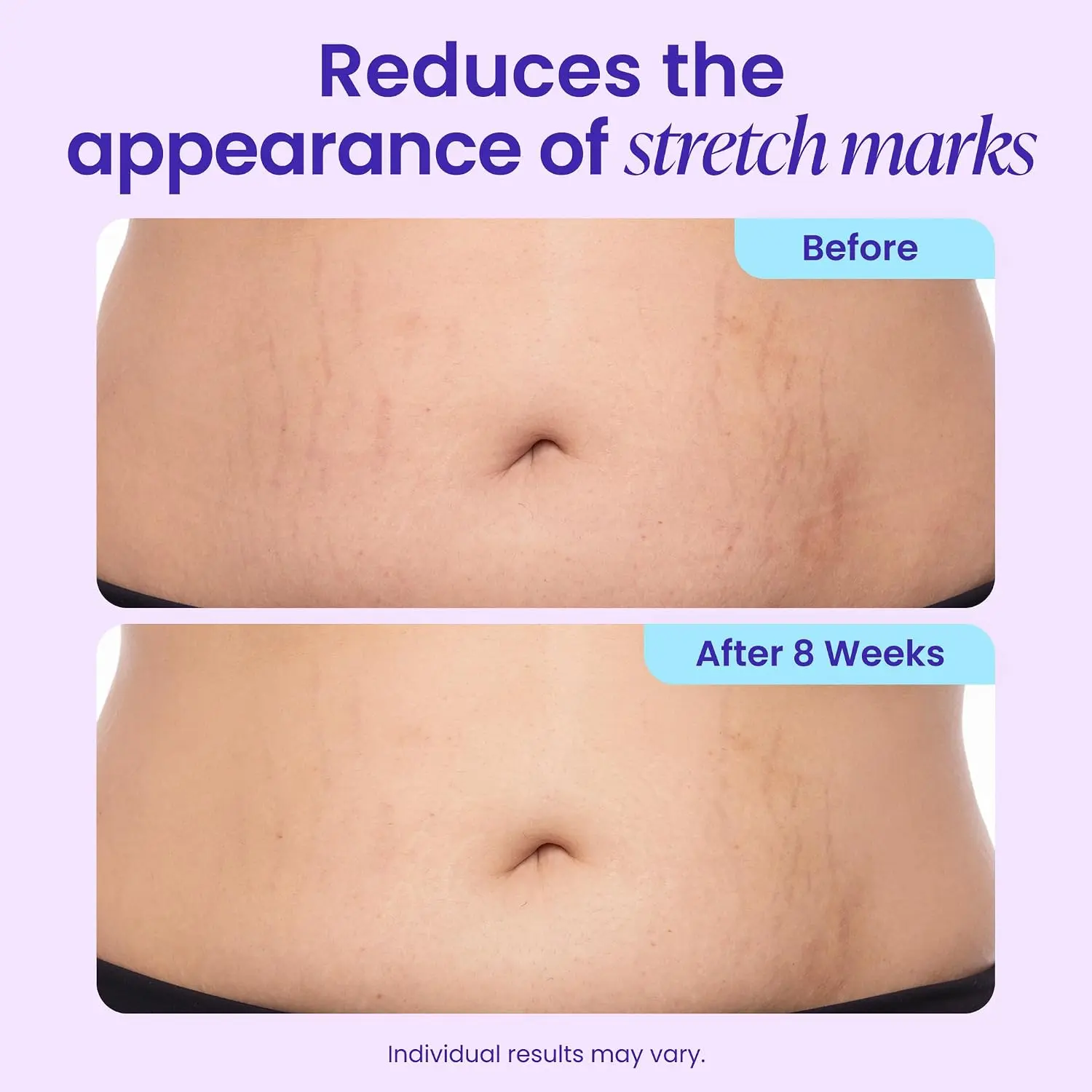 TummyRenew Firming & Smoothing Cream - Image 6