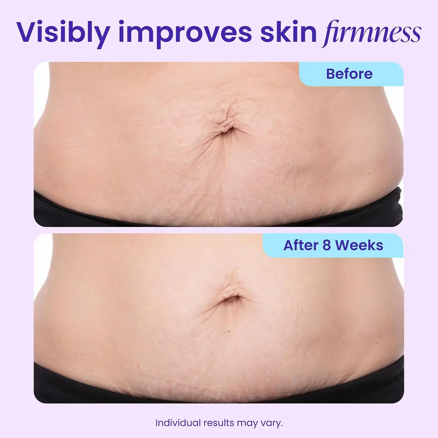 TummyRenew Firming & Smoothing Cream - Image 7