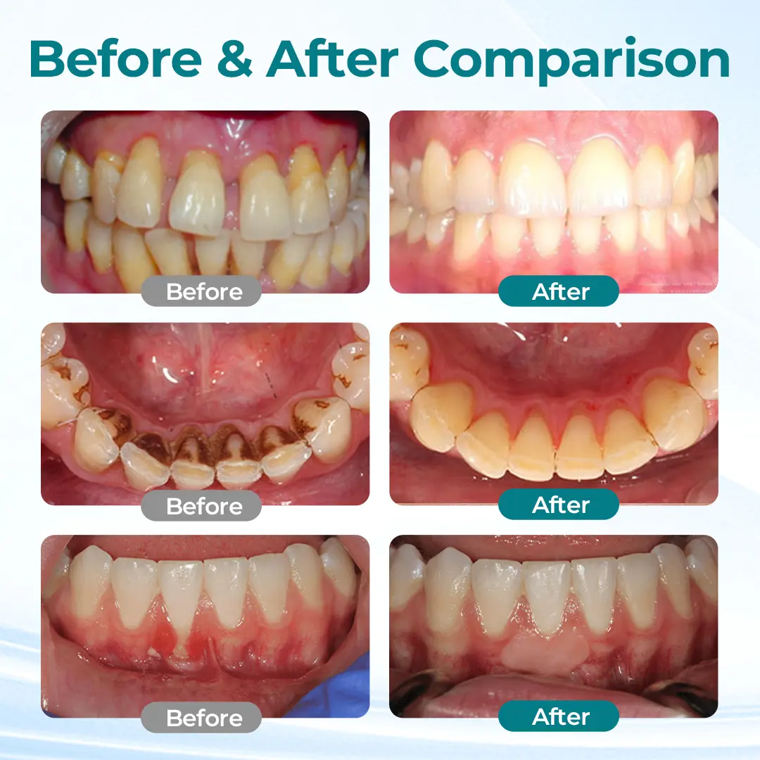 DentaRevive Enamel & Gum Repair Foam - Image 2