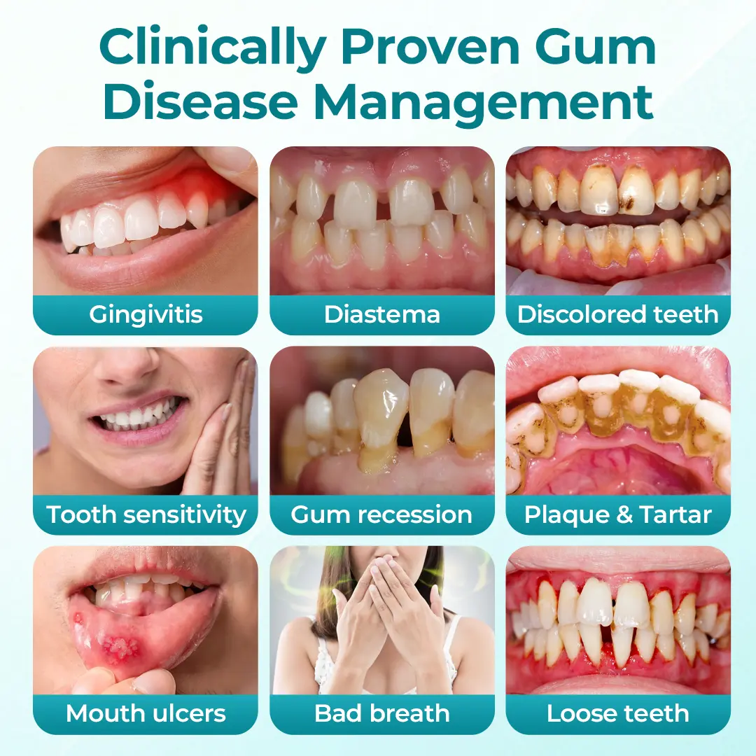 DentaRevive Enamel & Gum Repair Foam - Image 5