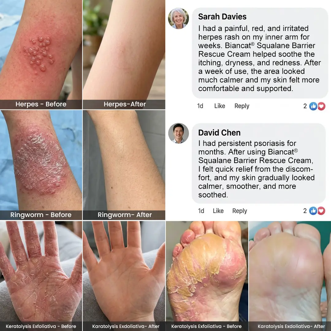 Squalane Barrier Rescue Cream - Image 2