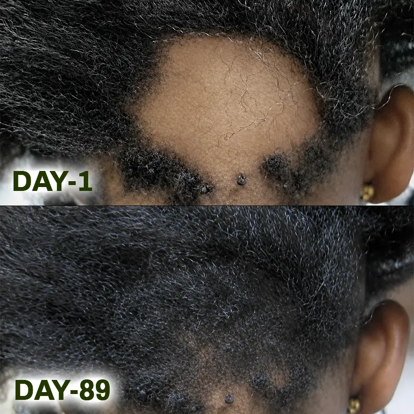 Batana Natural Hair Growth Oil - Image 5