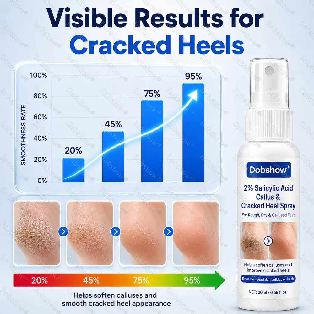 2% Salicylic Acid Callus & Cracked Heel Spray - Image 9