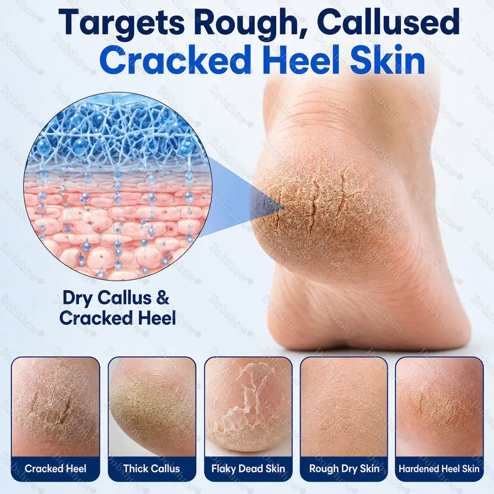 2% Salicylic Acid Callus & Cracked Heel Spray - Image 7