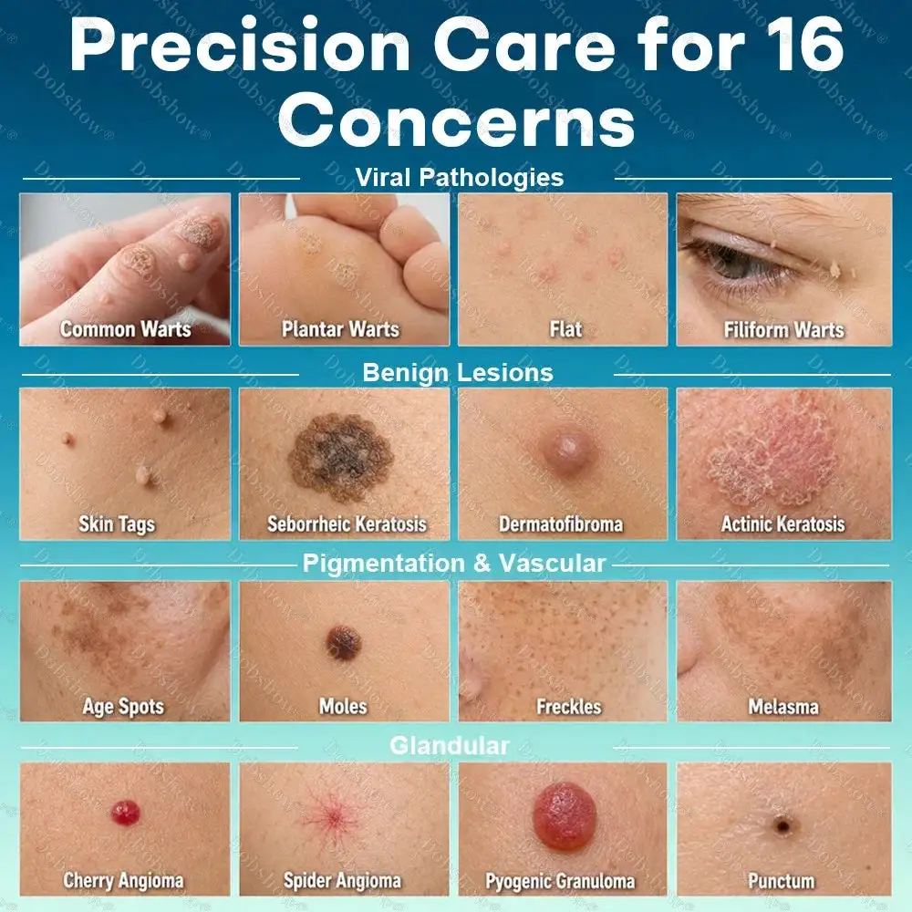 7 -Day Wart & Blemish Remover - Image 10