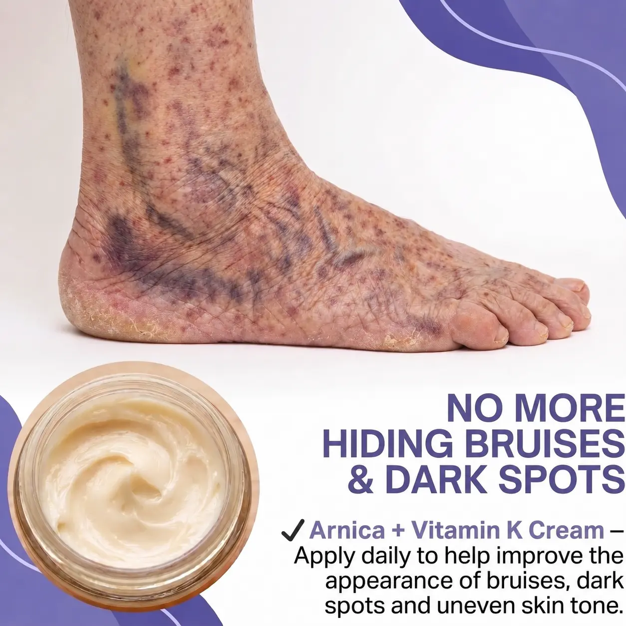 All-New Upgraded Dark Spot Correcting, Bruise Healing & Skin Strengthening Cream - Image 5