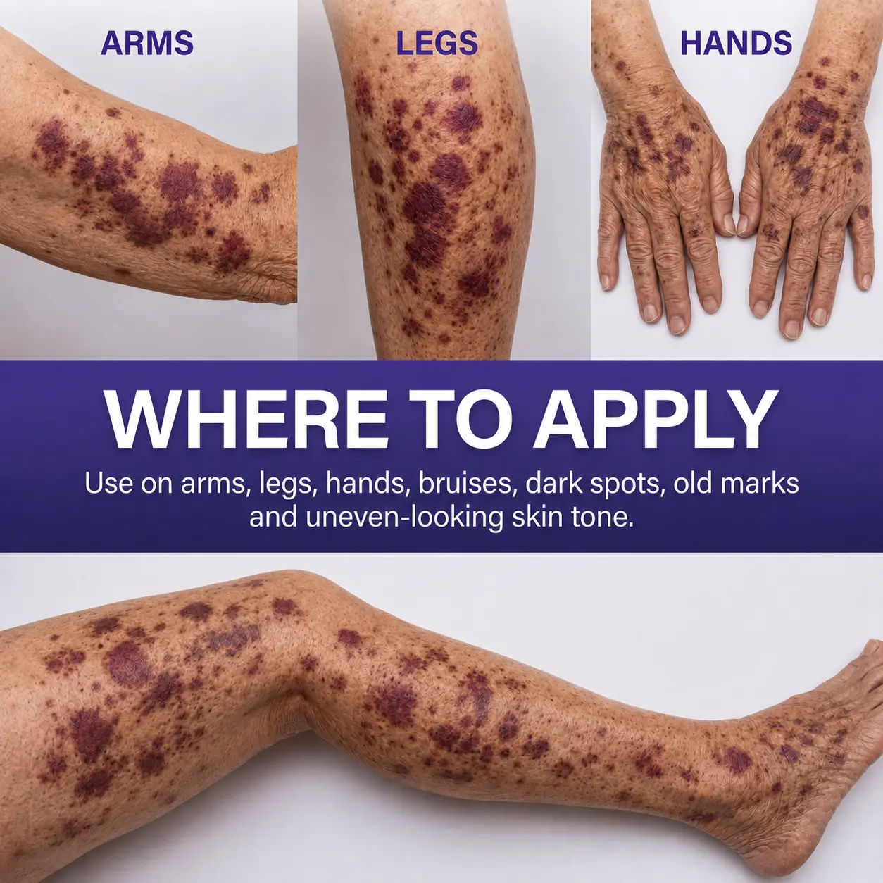 All-New Upgraded Dark Spot Correcting, Bruise Healing & Skin Strengthening Cream - Image 8