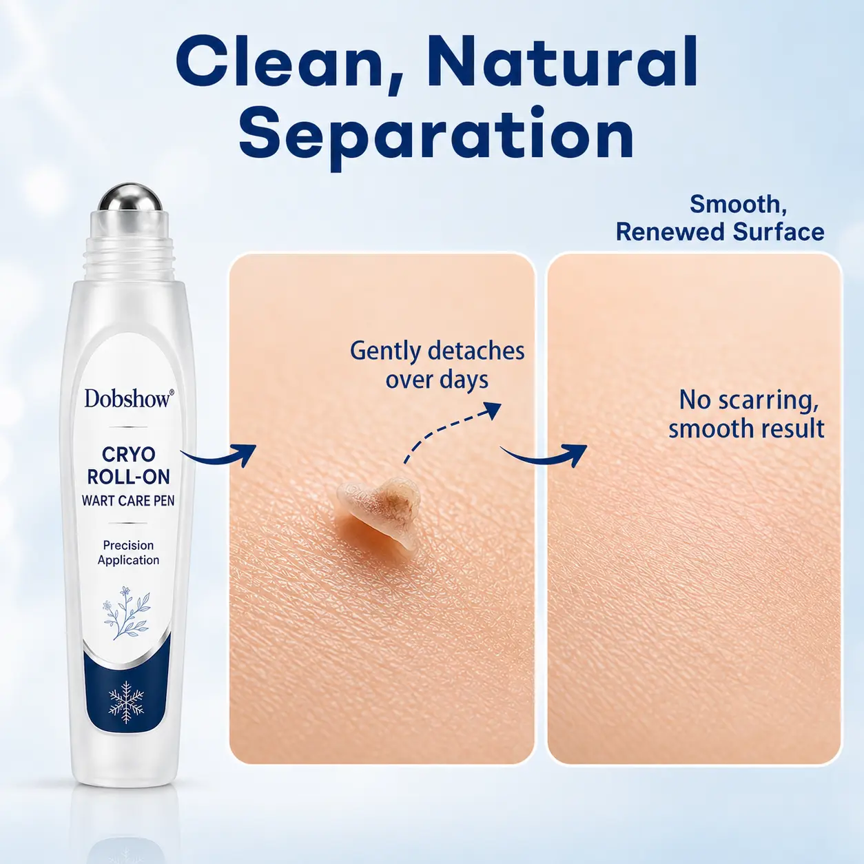 Newly Upgraded Precision Wart & Dark Spot Corrector Pen - Image 8
