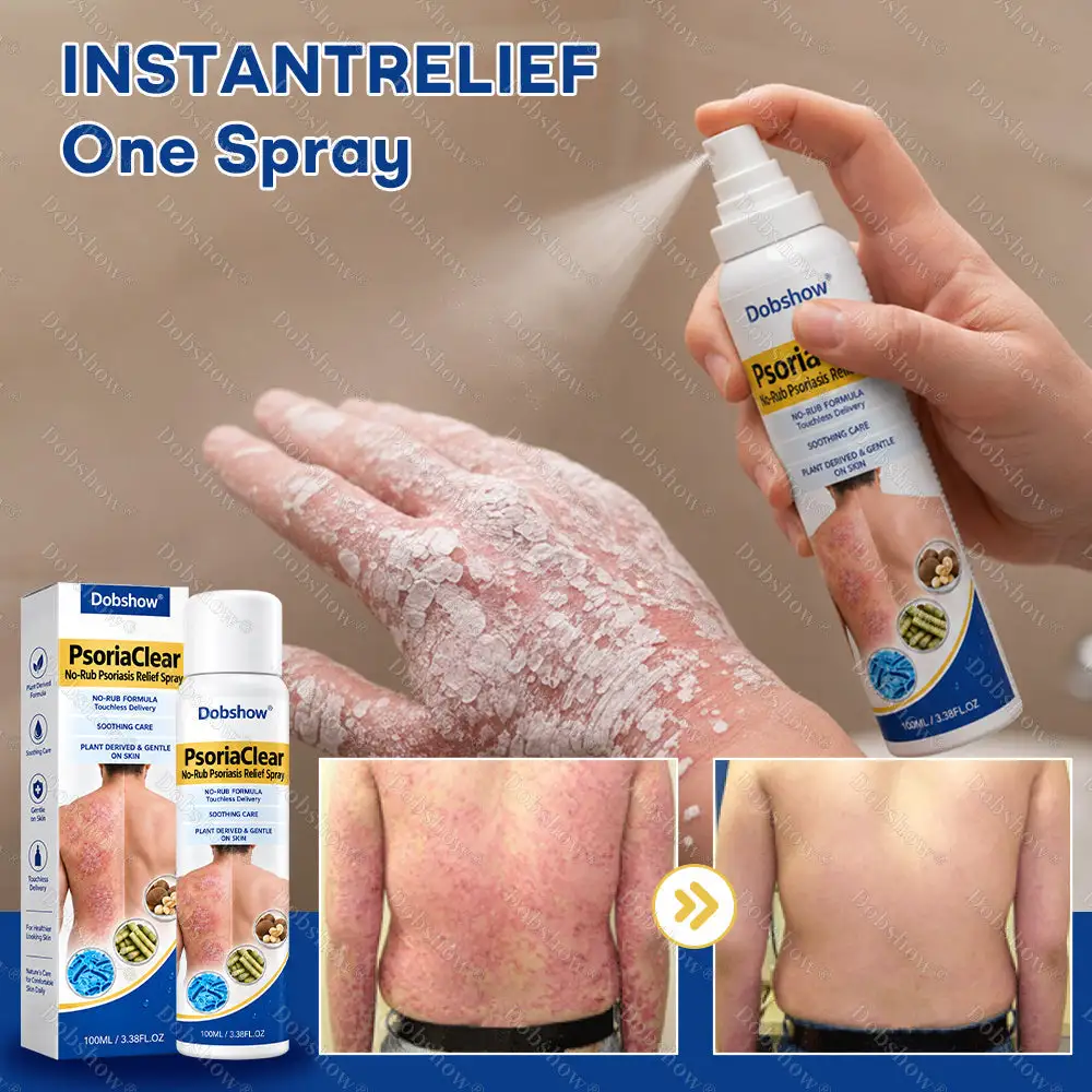PsoriaClear No-Rub Psoriasis Relief Spray - Image 2