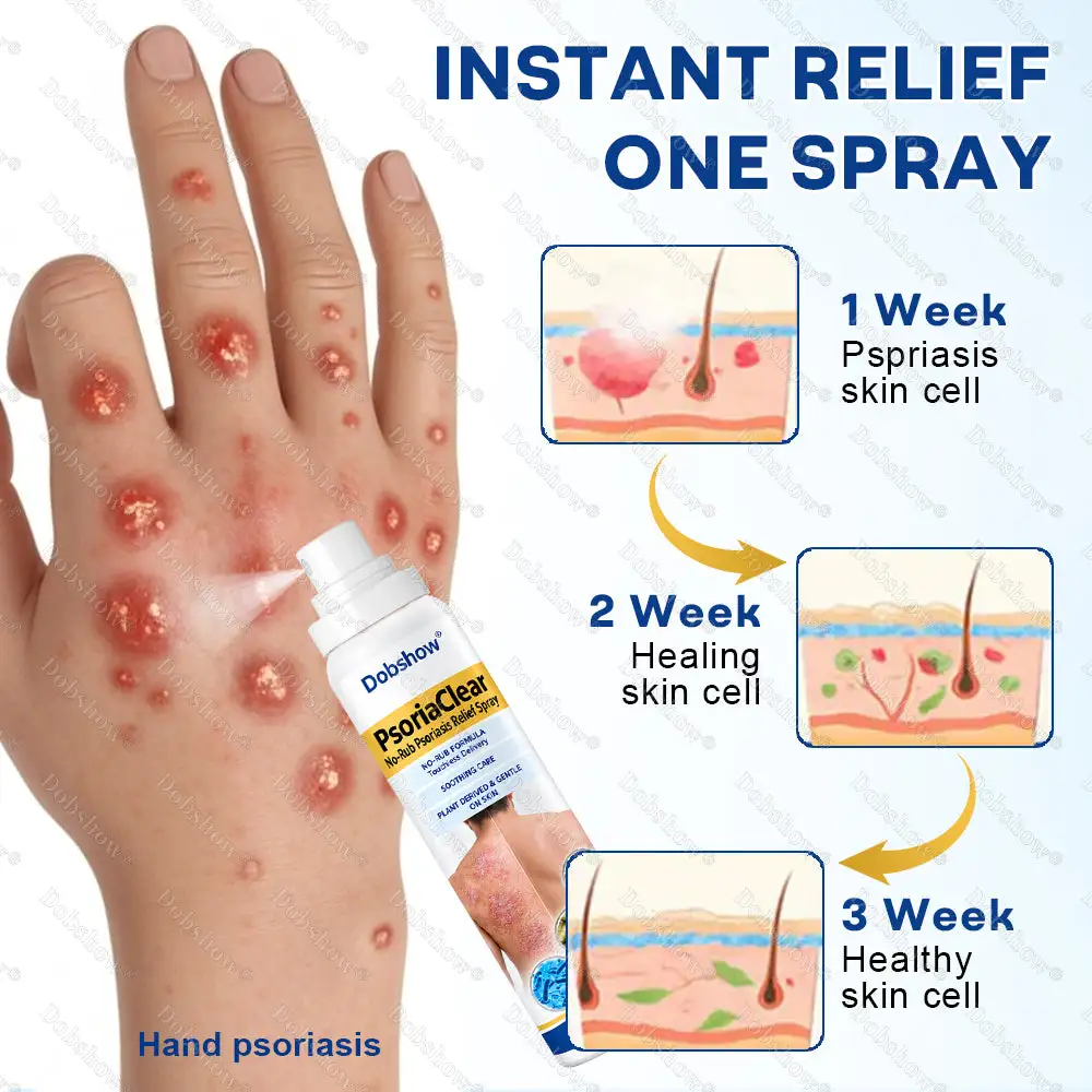 PsoriaClear No-Rub Psoriasis Relief Spray - Image 5