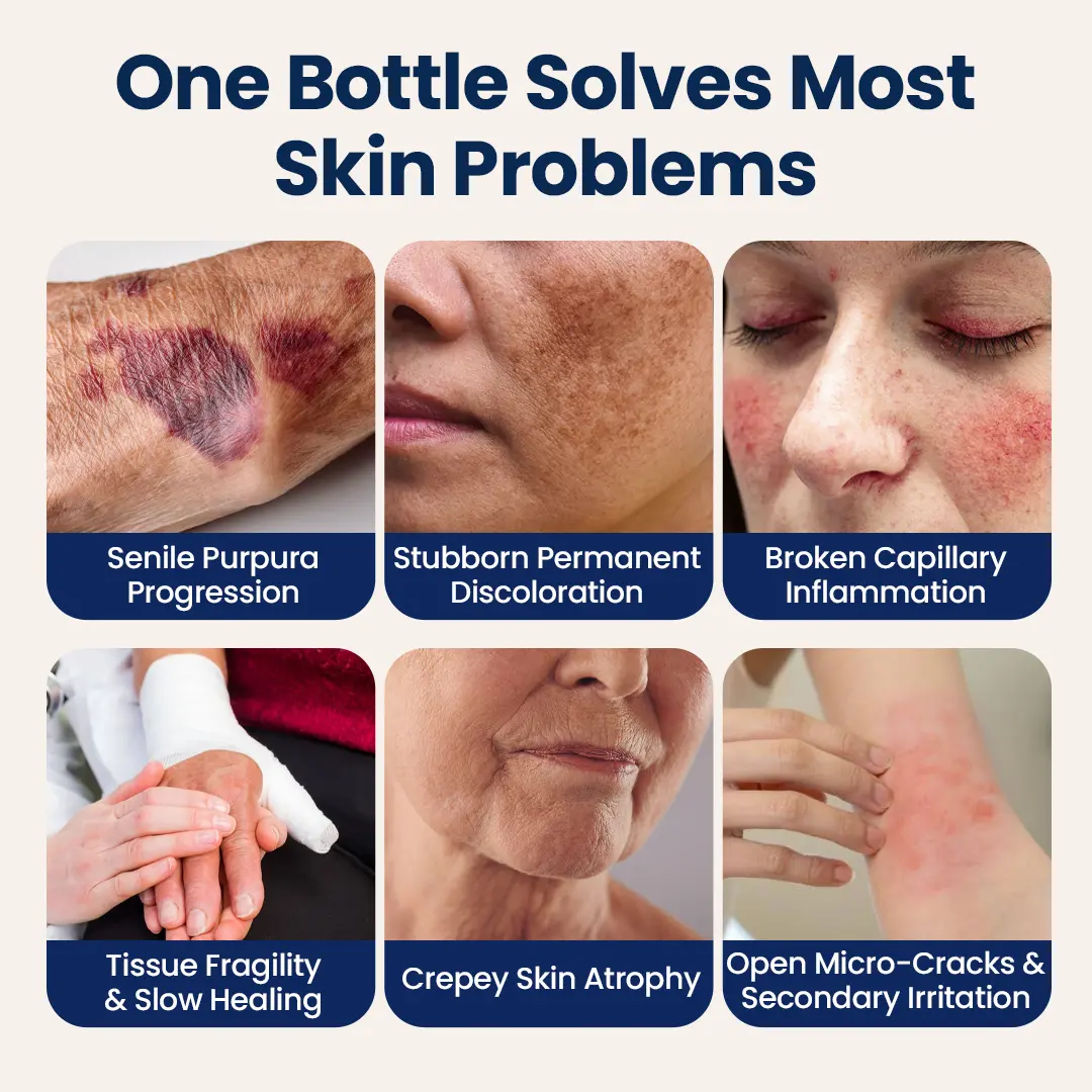 DermFortify - Advanced Bruise Fading & Skin Thickening Cream for Thin, Fragile Skin - Image 3
