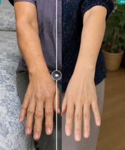 LIMETOW® MAGNETIC PATCH PRO