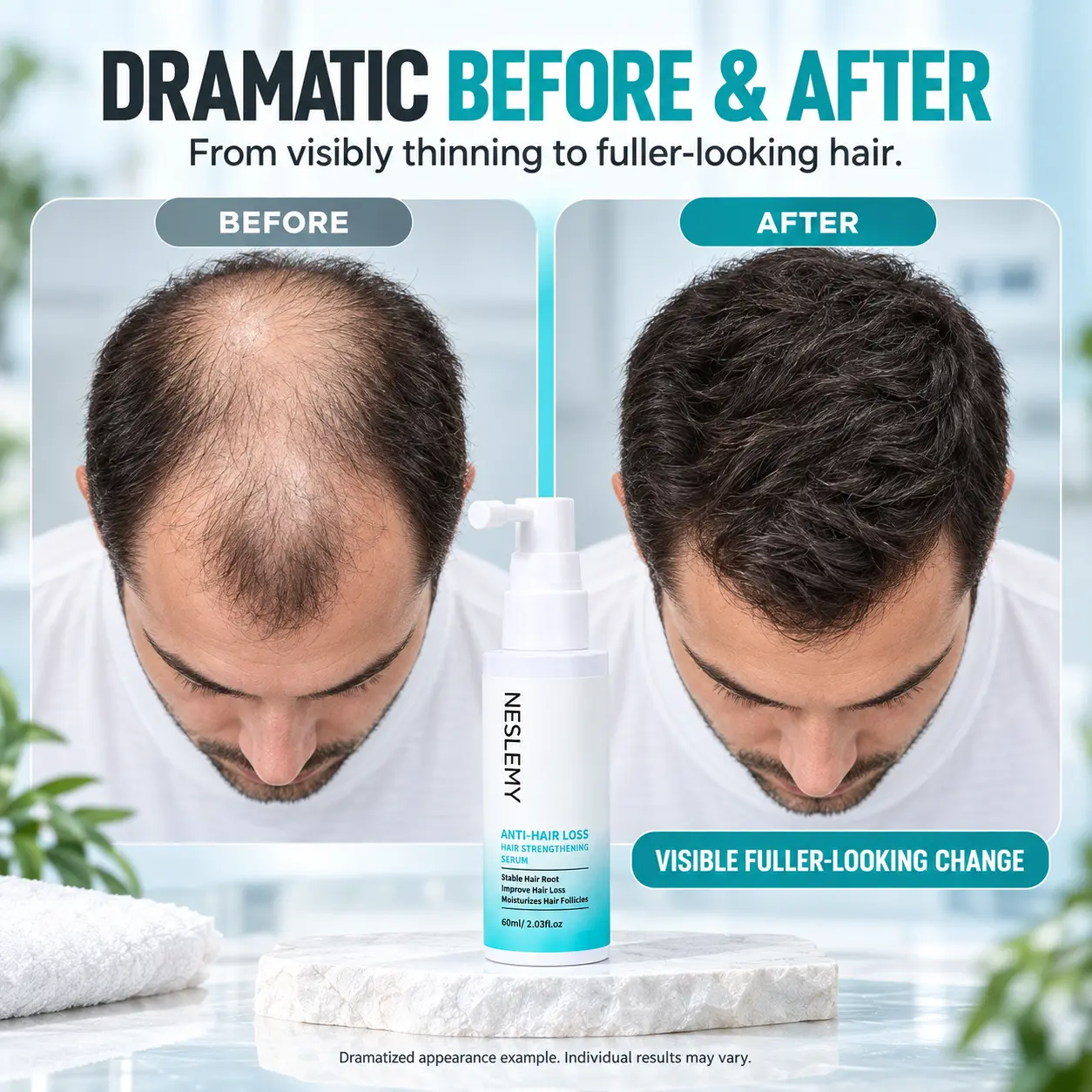 5% Minoxidil Hair Regrowth Treatment - Image 8